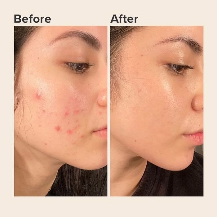 Hydra Glow Brightening Serum