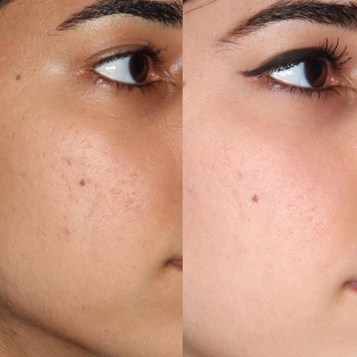 Hydra Glow Brightening Serum